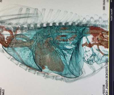 CT of Lung