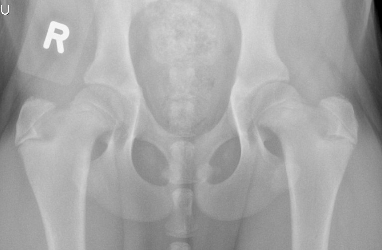 xray of normal puppy hips